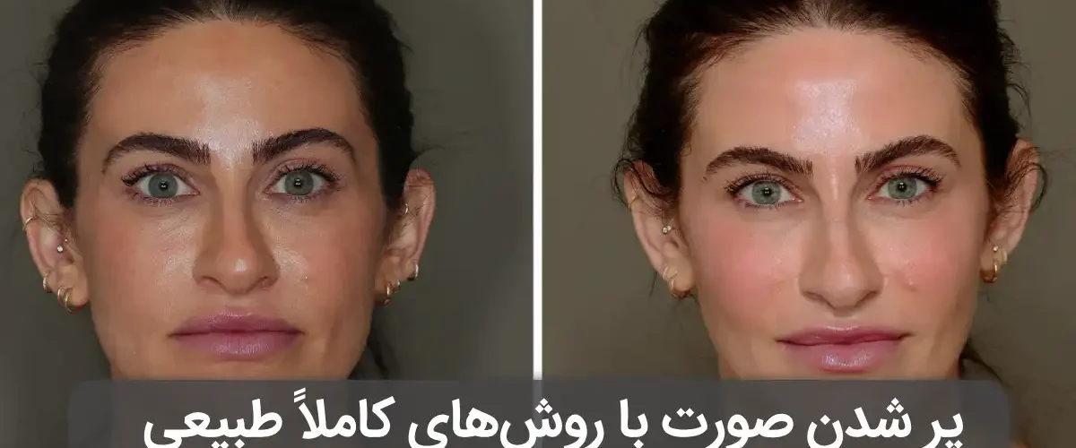 پر شدن صورت