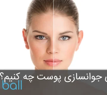 Skin rejuvenation 1 360x320