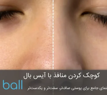 کوچک کردن منافذ با آیس بال